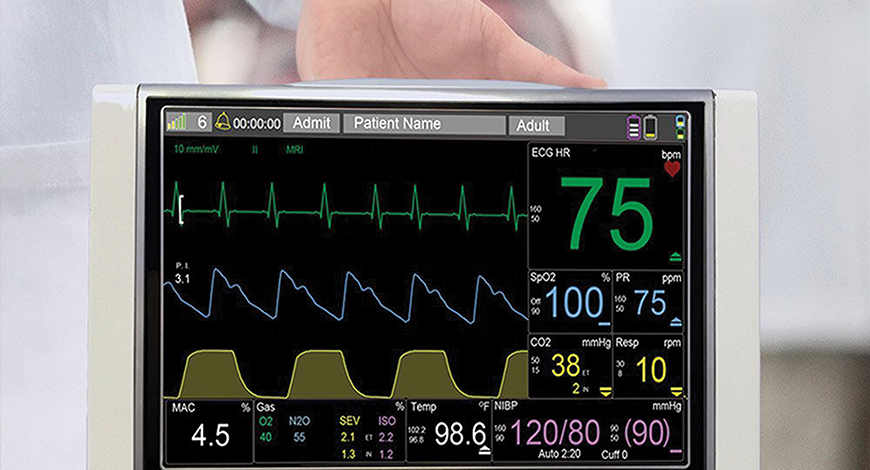 Screen Trends Patient monitoring decision support